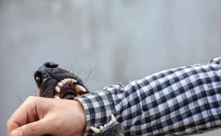 Está delicado niño atacado por perro en Obregón