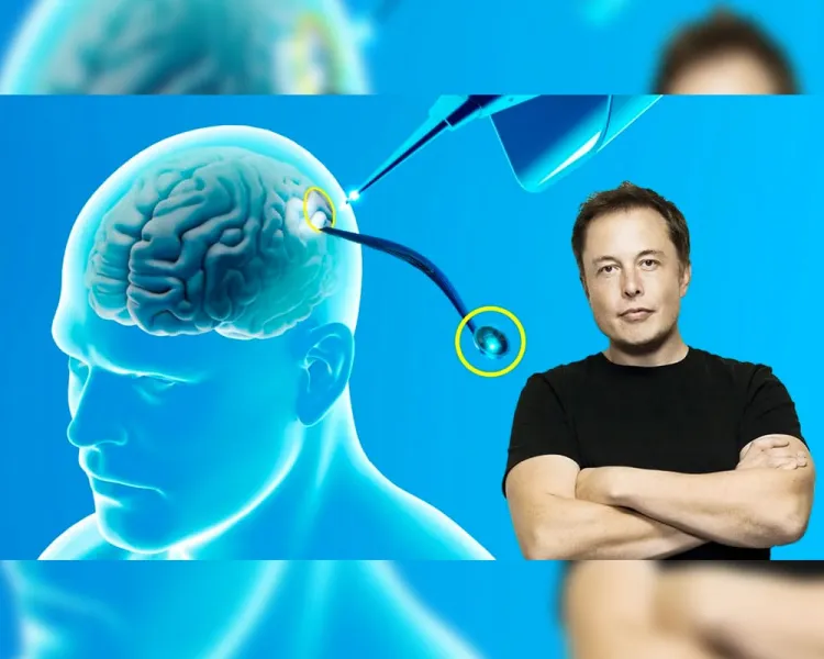 Implantan primer chip cerebral con Neuralink