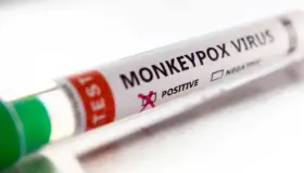 Modifica la OMS nombre de viruela del mono; ahora se llama 'mpox'