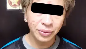 Entrega FGJE aprófuga de EU